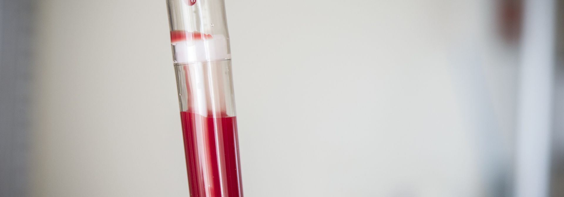 Stem cells infusing through an IV