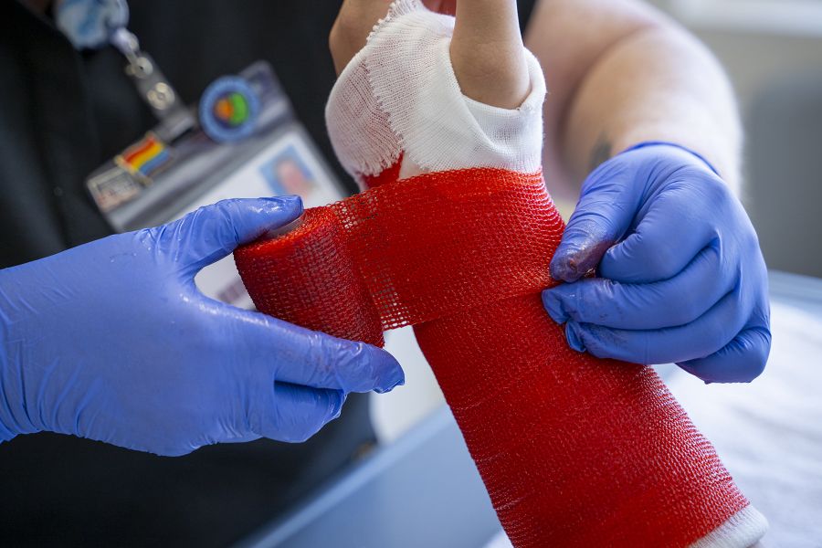 A close up shot of Teri’s gloved hands putting on a red cast on a young patient.